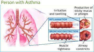 what is asthma and copd