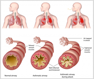 how to check for asthma