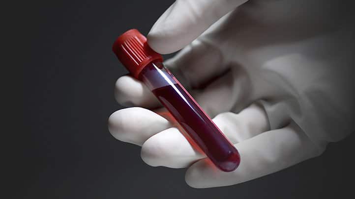 What Are The Blood Tests For Asthma